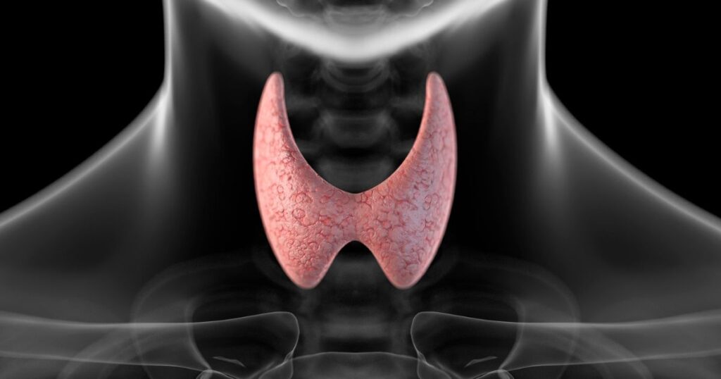 can thyroid problems cause tinnitus
