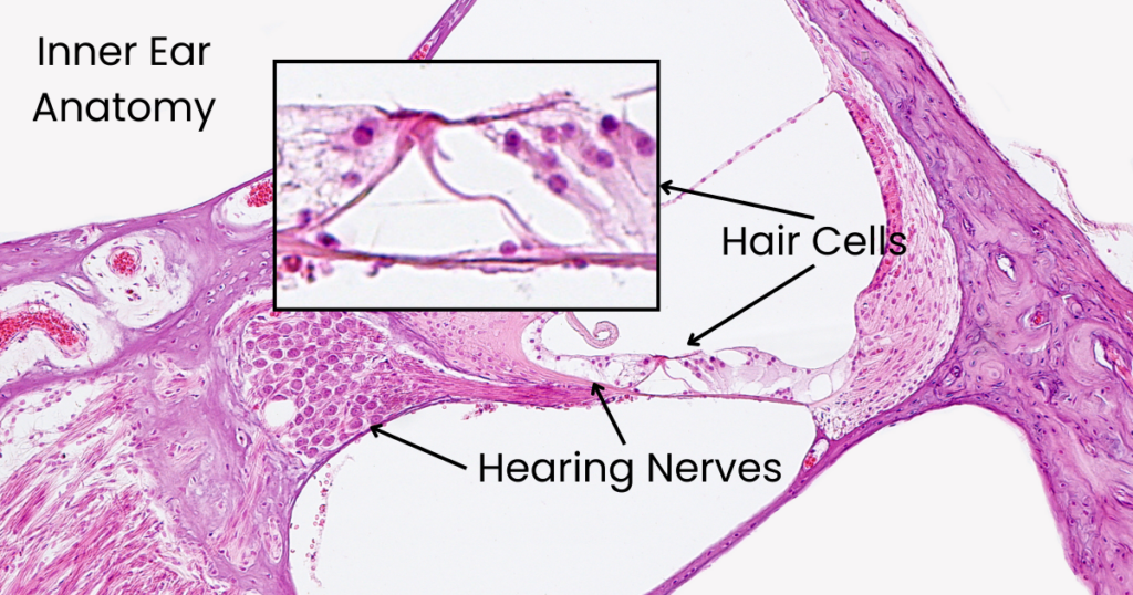 inner ear hair cells, when damaged, cause tinnitus