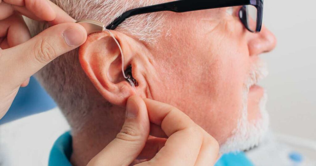 masking devices that look like hearing aids deliver white noise for tinnitus