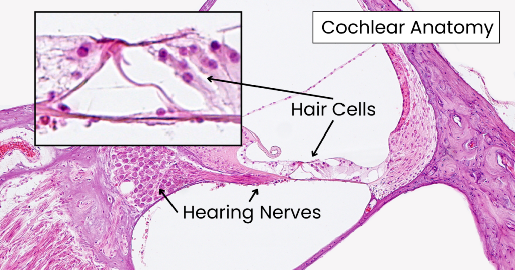 ear ringing after shooting is because of inner ear hair cell damage